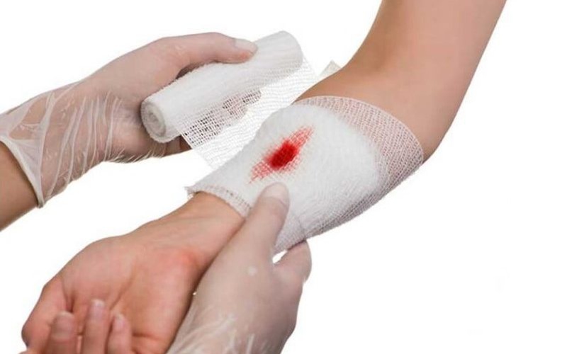 Liệu bị vết thương hở có nên ăn cá không? 2