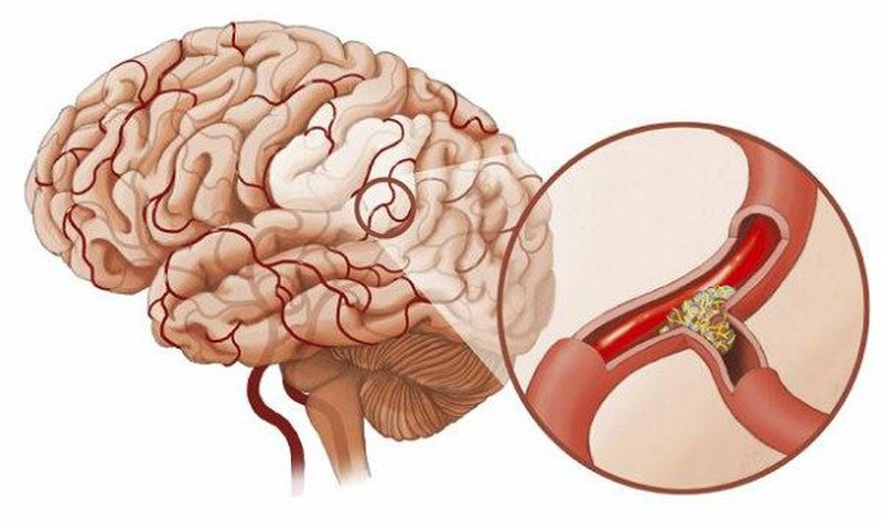 Những điều cần biết về suy hô hấp cấp ở trẻ em 2