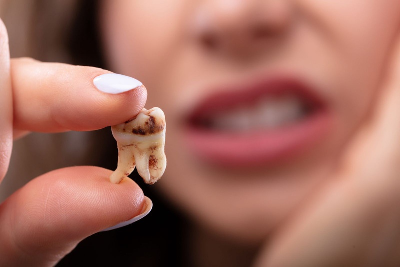 Viêm lợi có mủ - Nguyên nhân và hướng điều trị 2