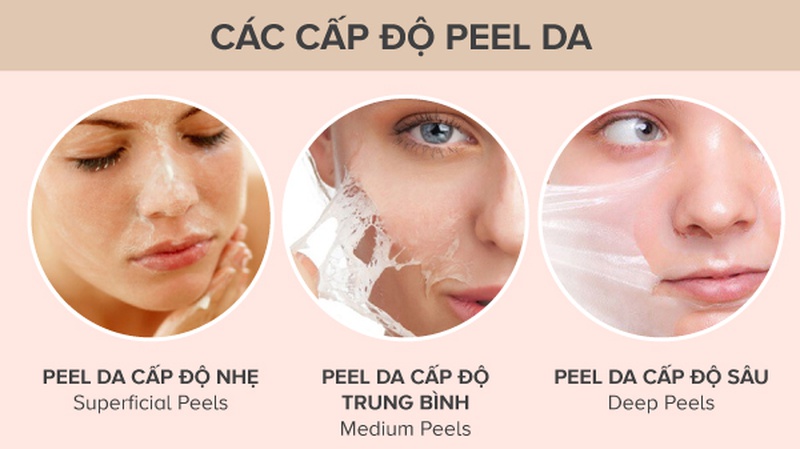 Sau khi peel da có nên dùng niacinamide? 2