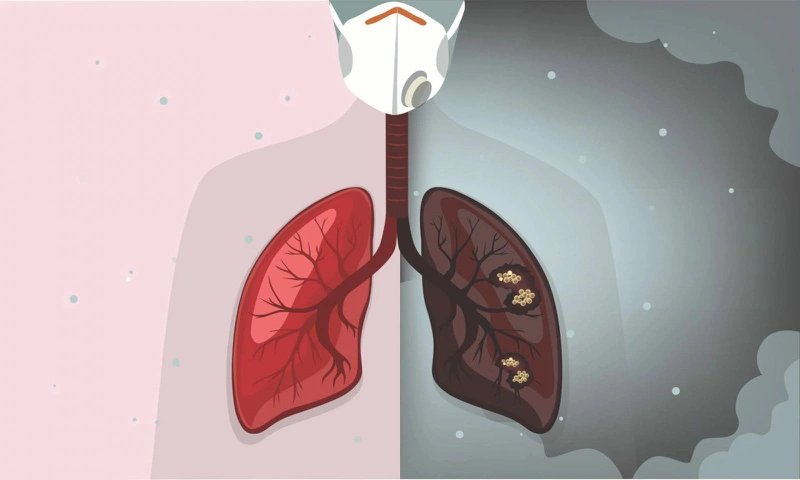 Bụi mịn trong nhà: Những tác hại nguy hiểm và cách loại bỏ chúng 2