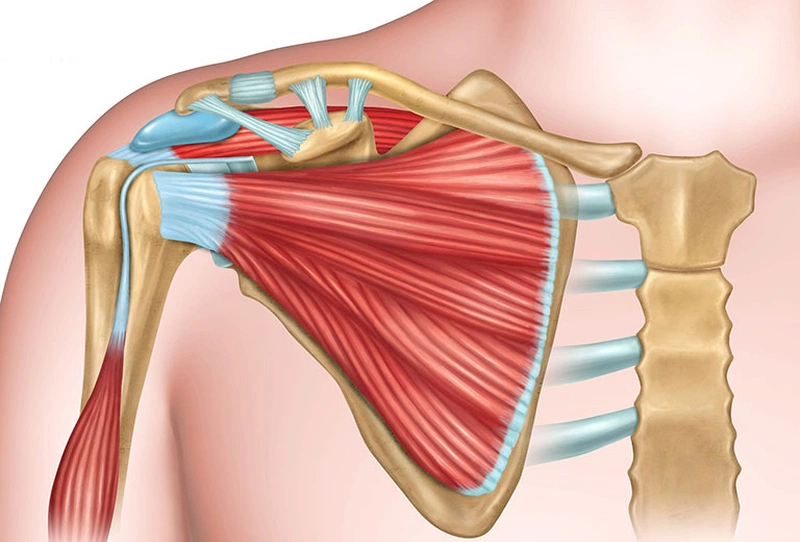 Các cách điều trị giãn dây chằng bả vai nhanh khỏi nhất 1