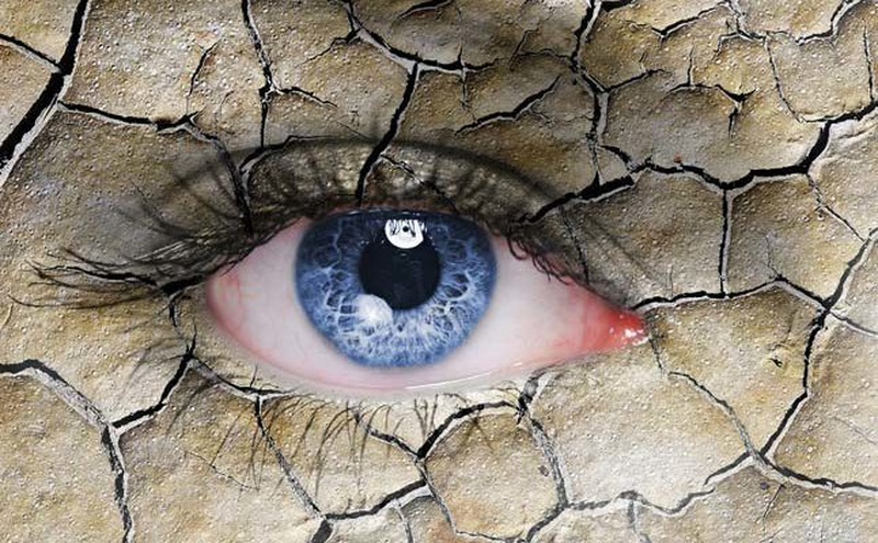 Hội chứng khô mắt là gì? Nguyên nhân và dấu hiệu nhận biết 1