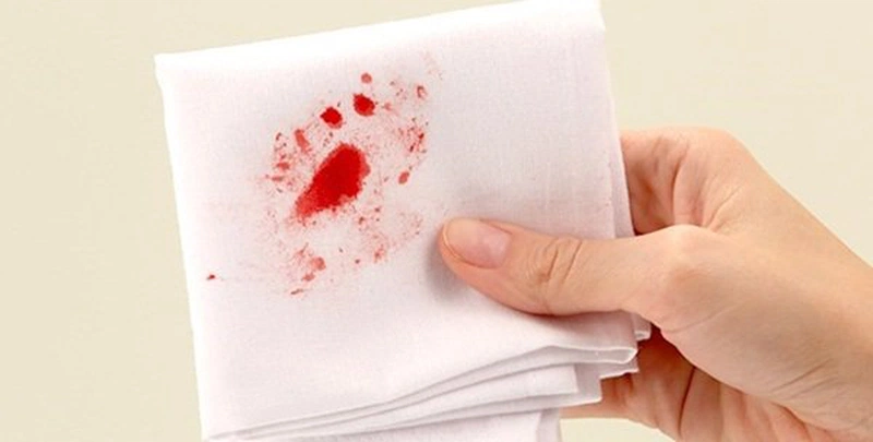Bỏ túi các dấu hiệu của bệnh trĩ cấp độ 4 để đề phòng 2