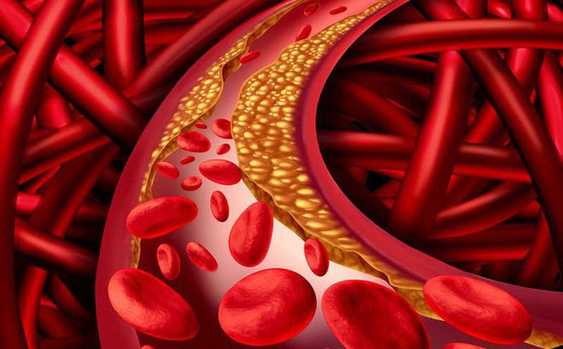 Bí quyết giảm mỡ trong máu hiệu quả không nên bỏ qua 1