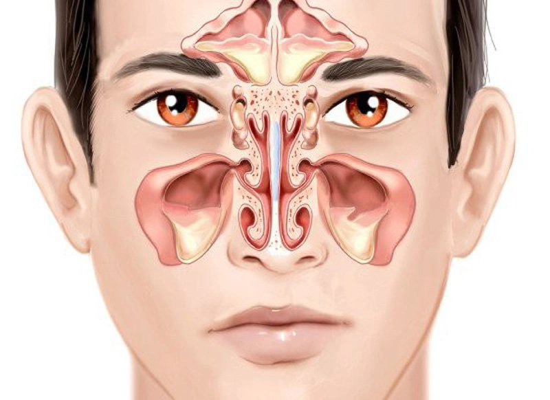 Những lưu ý cần biết khi khí dung điều trị viêm xoang 1
