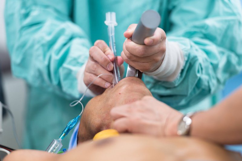 Quá trình nội soi phế quản có đau không? 1