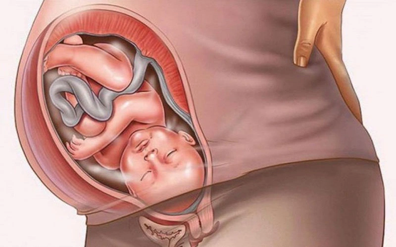 Sự bất thường của phôi là nguyên nhân khiến mẹ bầu không giữ được thai nhi