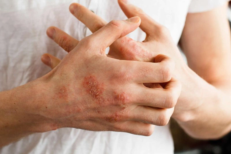 Đừng để dị ứng bao cao su cản trở cuộc yêu của bạn! 1