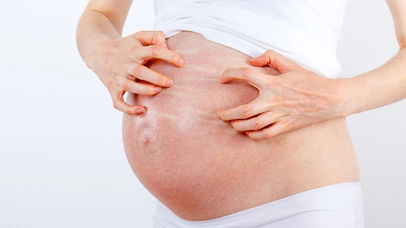 Tư vấn thông tin: Dị ứng hải sản ở bà bầu và các cách xử lý 1