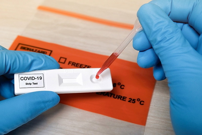 co-test-covid-truoc-khi-tiem-khong-nhung-dieu-can-biet-truoc-khi-tiem