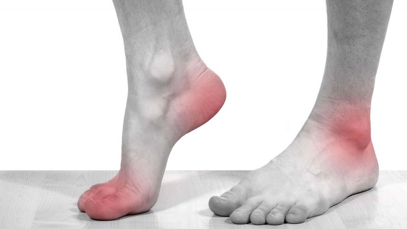 3 cách chữa bệnh gút bằng quả dừa 1
