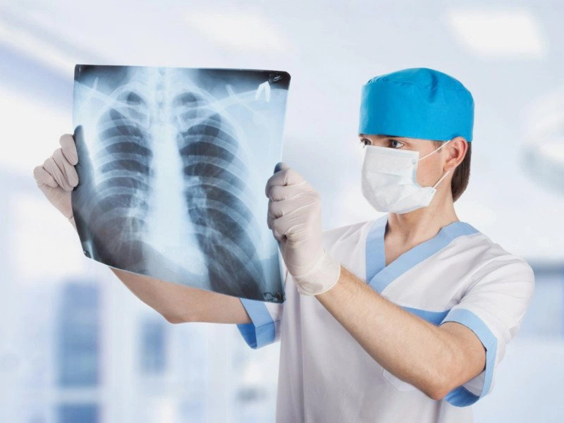Ung thư phổi thứ phát và những điều bạn cần biết về nó 3
