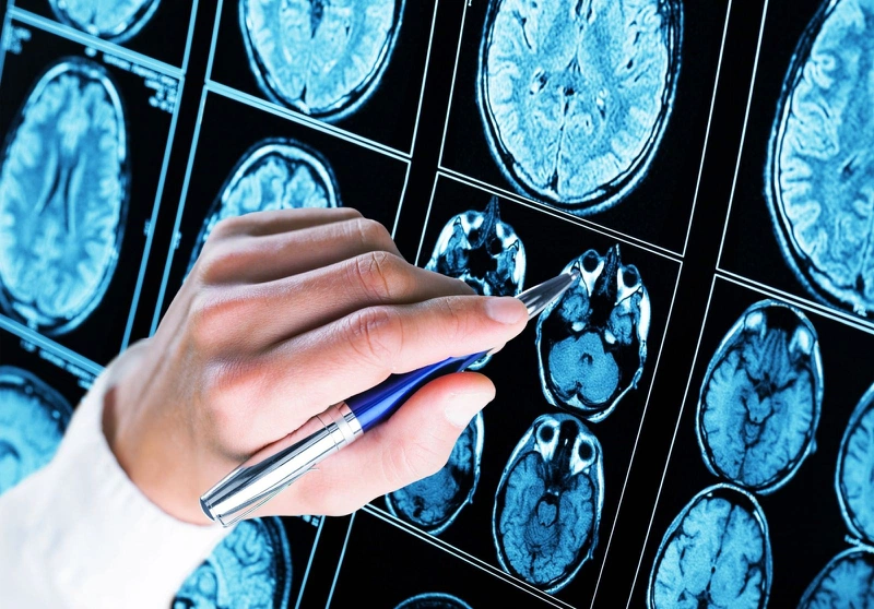Neurogesic-M là thuốc gì? Cách sử dụng Neurogesic-M như thế nào để đạt hiệu quả điều trị? 2