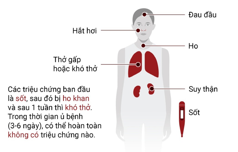 Virus corona chủng mới gây viêm đường hô hấp cấp (hay còn gọi là nCoV, virus corona Vũ Hán, bệnh viêm phổi Vũ Hán) đang hoành hành1