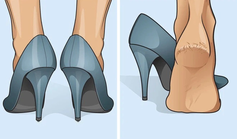3 cách trị nứt gót chân bằng Vaseline bạn đã biết chưa? 2