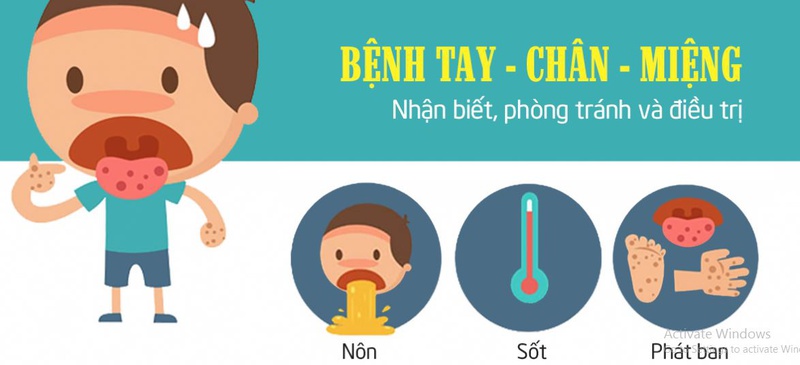 4 cấp độ của bệnh tay chân miệng và cách điều trị hiệu quả