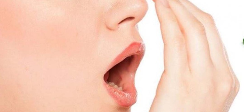 6 bệnh răng miệng thường gặp 4