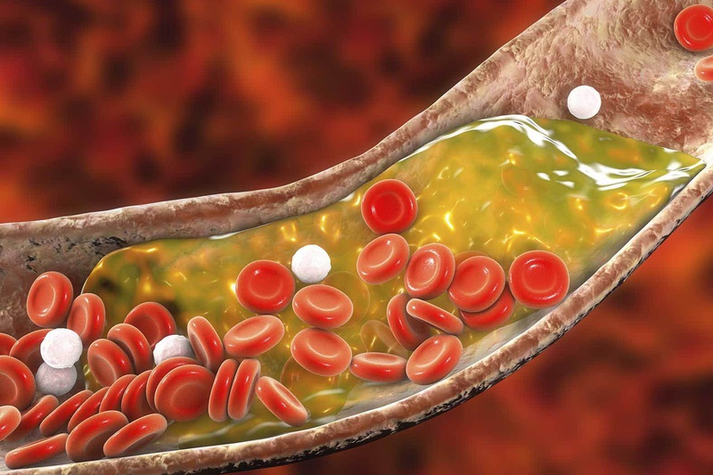 6 cách giúp kiểm soát tốt lượng cholesterol trong máu1