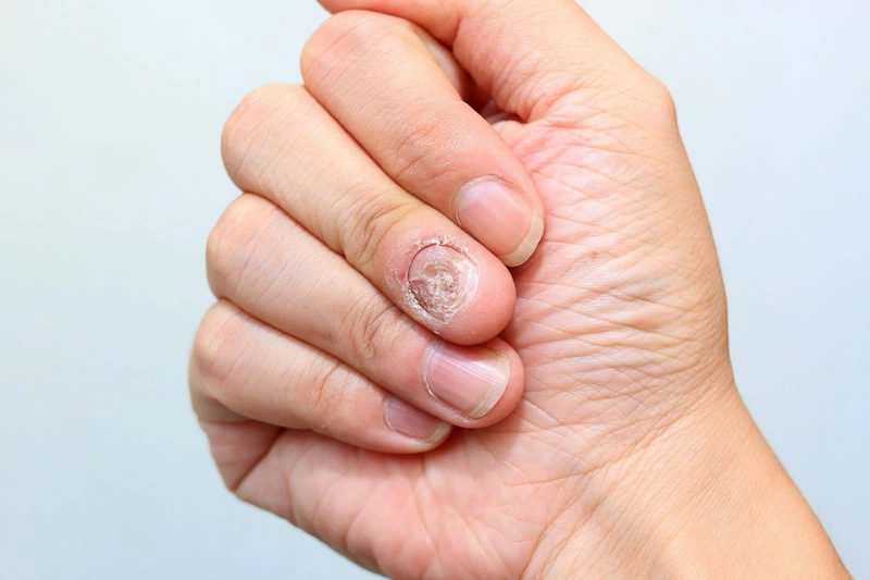 6 lý do khiến tay bạn có mùi và cách ngăn chặn hôi tay hiệu quả 3