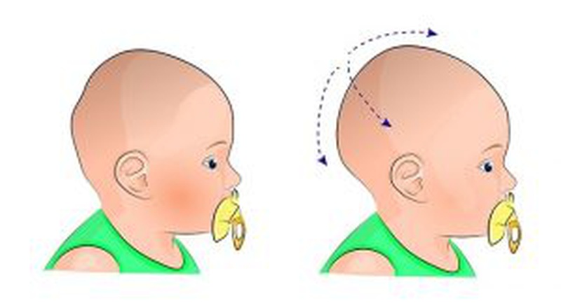 7 dấu hiệu sức khỏe của trẻ mà mẹ cần đưa bé đến gặp bác sỹ ngay 4