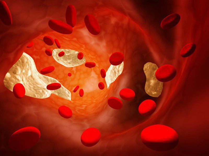 8 cách giúp bạn giảm cholesterol máu - Nhà thuốc FPT Long Châu