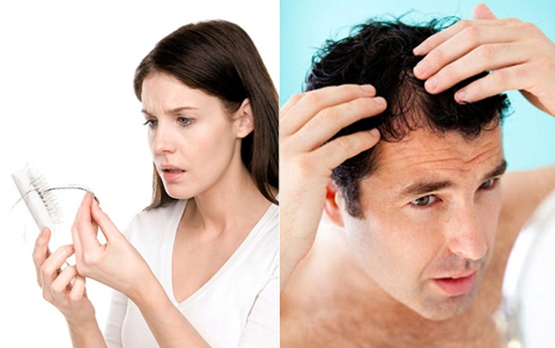 8 loại thuốc gây ra rụng tóc và cách khắc phục - Nhà thuốc FPT Long Châu