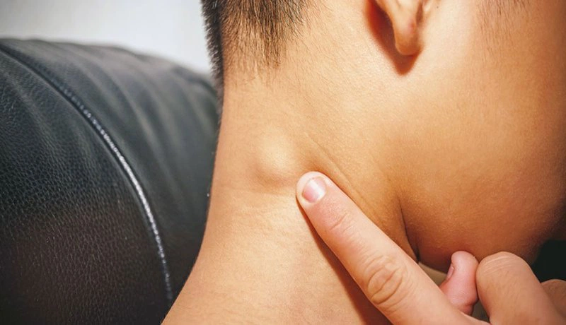 9 Dấu hiệu cảnh báo sớm ung thư máu