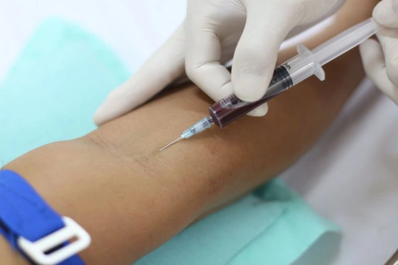 An toàn tình dục khi bị nhiễm HIV: Liệu hôn nhau có bị lây HIV không? 2