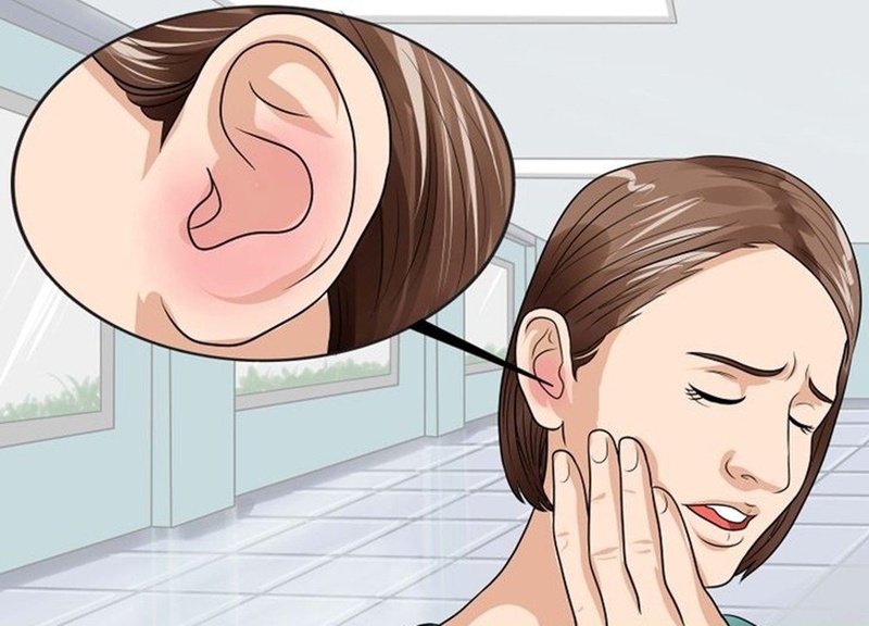 Bác sĩ trả lời câu hỏi Bệnh Meniere có chữa khỏi được không 2