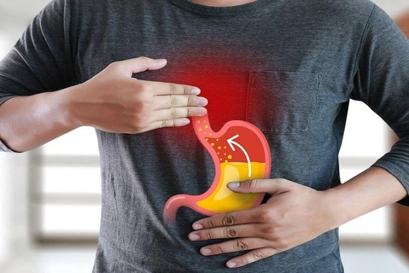 Bật mí nên ăn gì để giảm tiết axit dạ dày hiệu quả 1