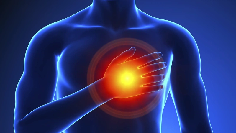 Bệnh ngừng tim đột ngột là tình trạng rối loạn nhịp tim khiến tim ngừng đập ngay lập tức 1