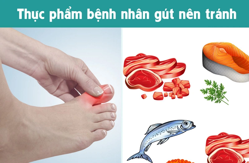 Bệnh nhân Gout có uống nước yến hoặc ăn tổ yến được không 2