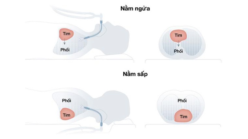Bài tập tăng nồng độ oxy trong máu an toàn, đơn giản cho F0 đang điểu trị tại nhà