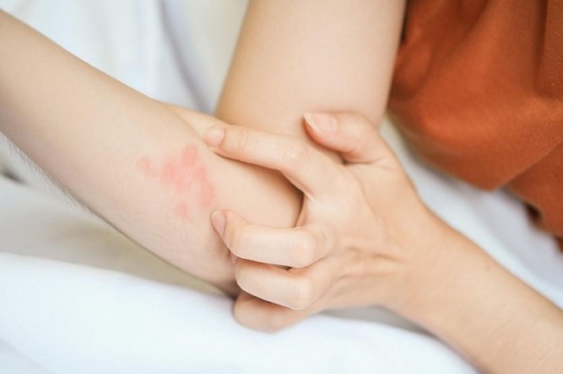 Các dấu hiệu tiểu đường trên da bạn không nên bỏ qua 1