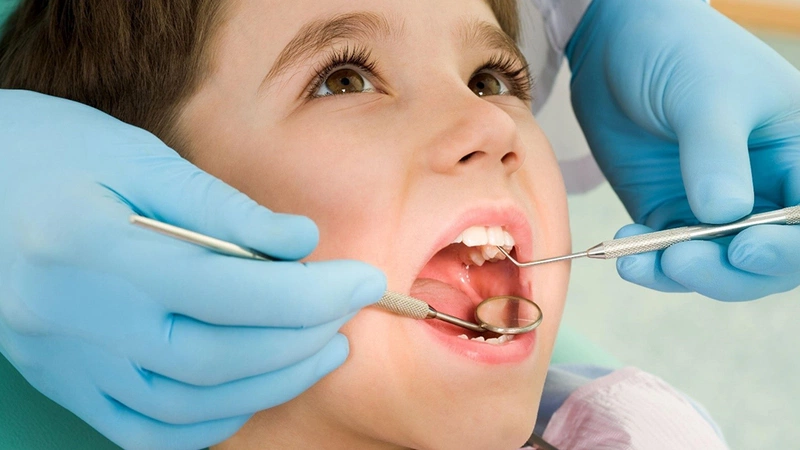 Phương pháp chữa sâu răng nhẹ: tái khoáng răng sâu