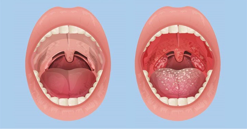 Cây tướng quân là gì và các bài thuốc quý từ dân gian 4