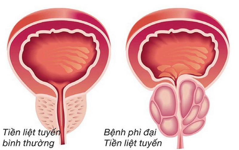 Cây tướng quân là gì và các bài thuốc quý từ dân gian 5