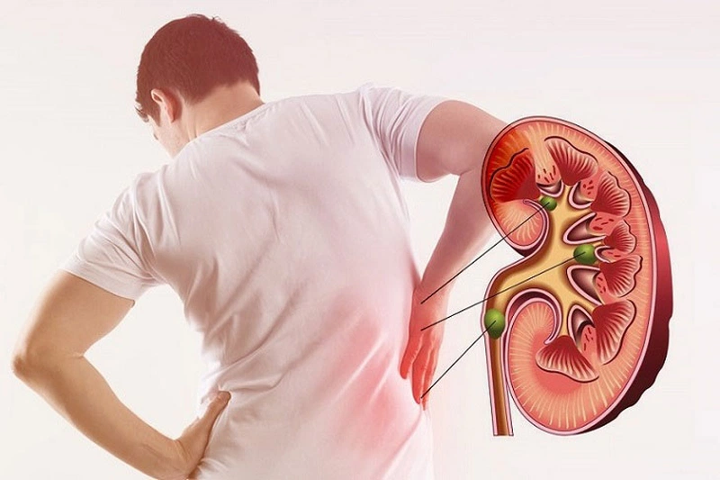 Chia sẻ khoai môn bao nhiêu calo Ăn khoai môn có béo không 5
