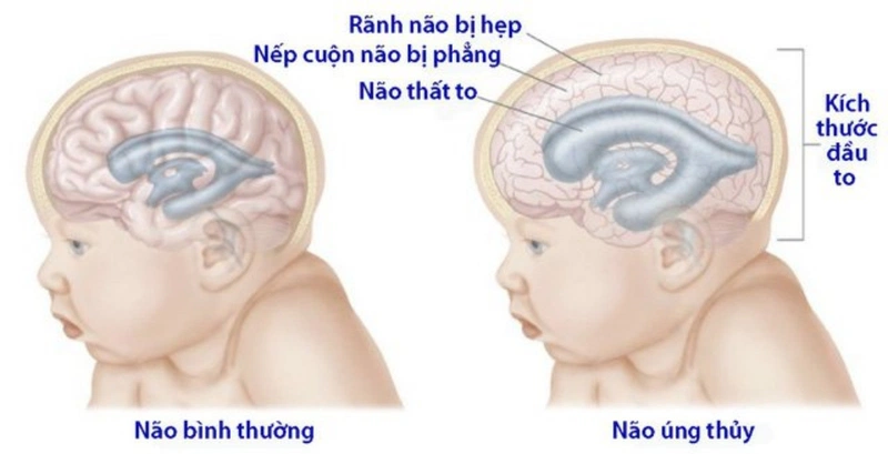 Chu vi vòng đầu thai nhi là gì? Chỉ số quan trọng tới sức khỏe mẹ và bé 5