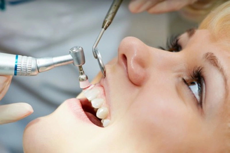 Đánh bóng răng có hại không? Lưu ý gì khi đánh bóng răng 3