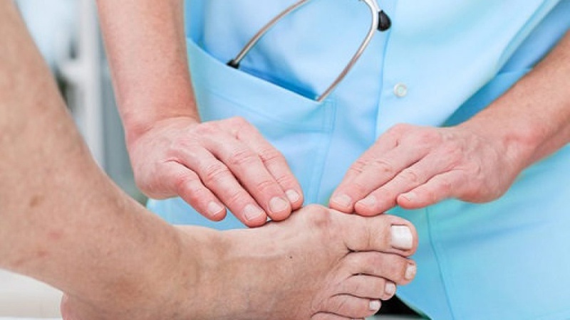 Đau buốt khớp ngón chân cái - Cảnh báo bệnh lý nguy hiểm gì 2