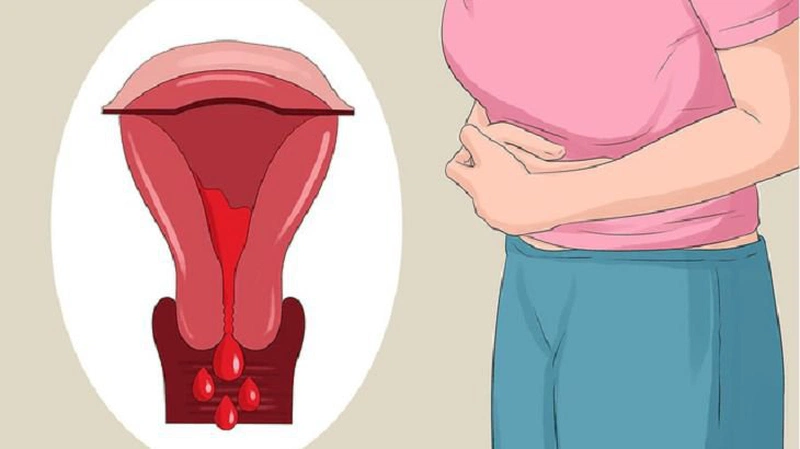 Dấu hiệu mang thai khi kinh nguyệt không đều là như thế nào 2