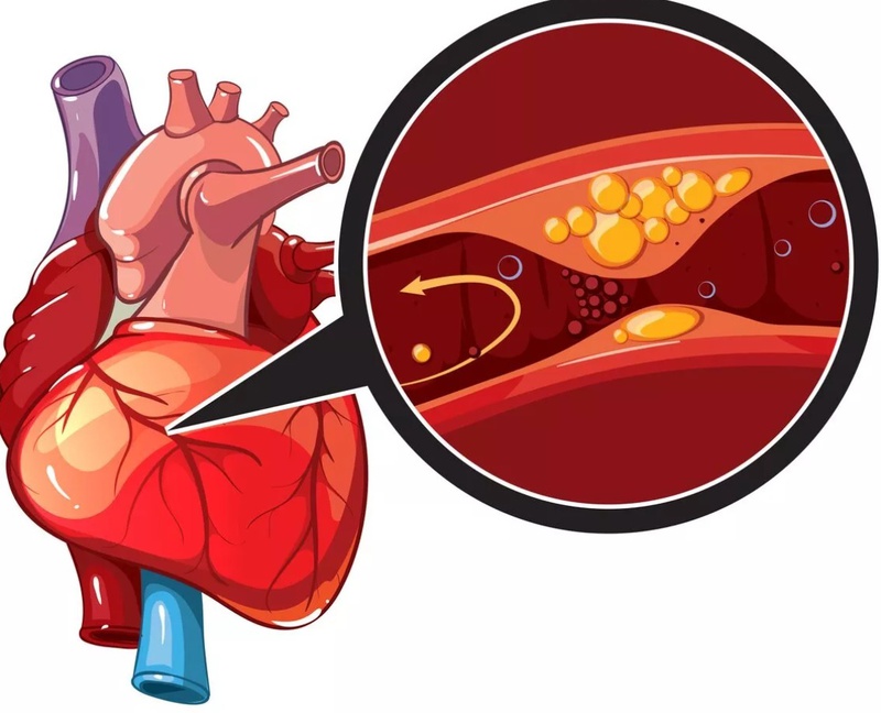 Đau tức ngực khó thở có nguy hiểm không? 2