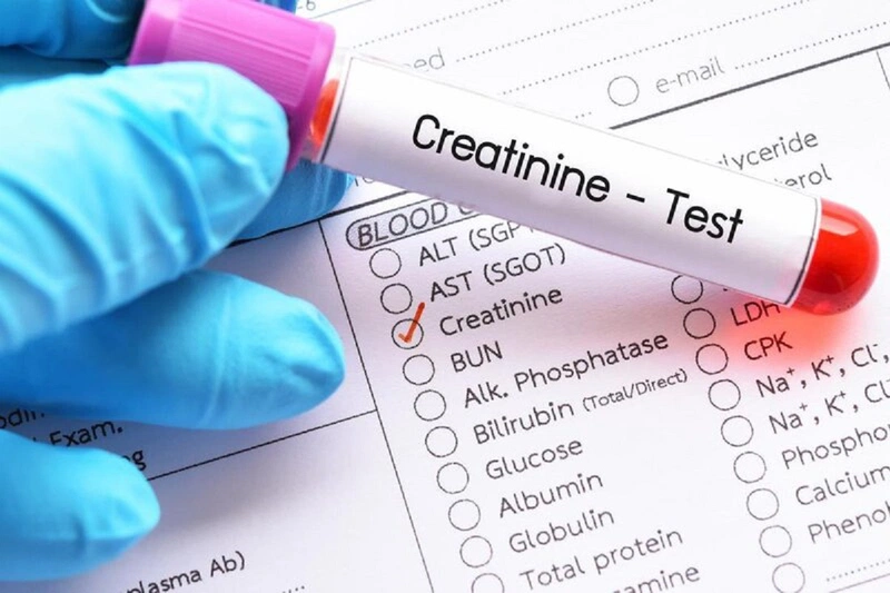 Độ lọc cầu thận bình thường là bao nhiêu? Cách tính độ lọc cầu thận 5
