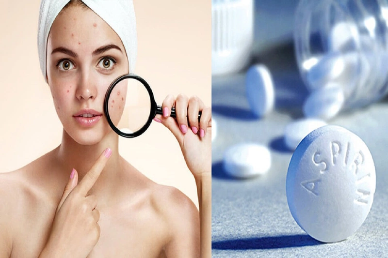 Dùng aspirin trị mụn có thật sự an toàn và hiệu quả hay không? 1