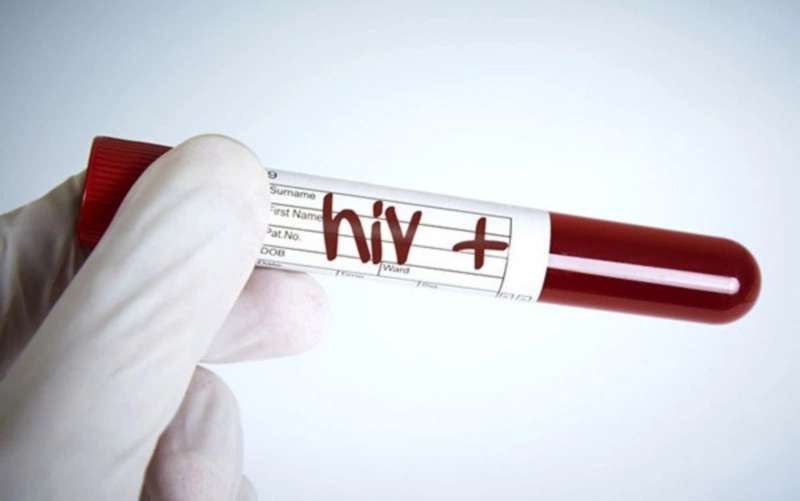Giai đoạn cửa sổ HIV kéo dài bao lâu? Các triệu chứng thường gặp trong giai đoạn cửa sổ là gì? 4