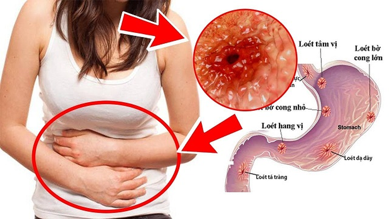 Gợi ý cách làm mứt dừa ngon chuẩn vị 4