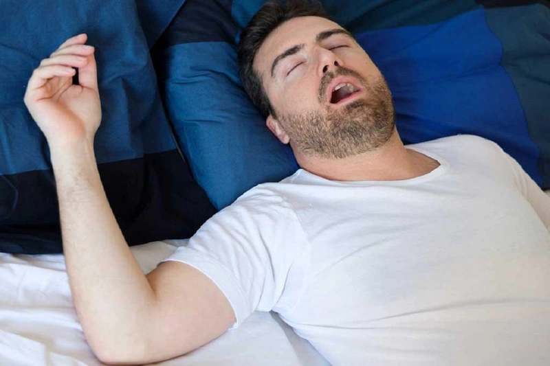 Hội chứng ngưng thở khi ngủ là gì? Cách điều trị hội chứng ngưng thở khi ngủ