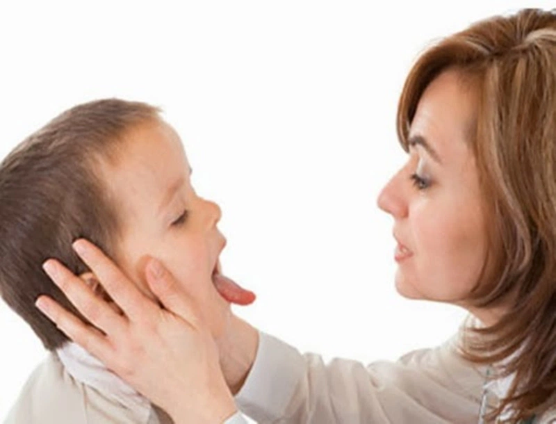 Mẹo sơ cứu trẻ bị hóc xương cá